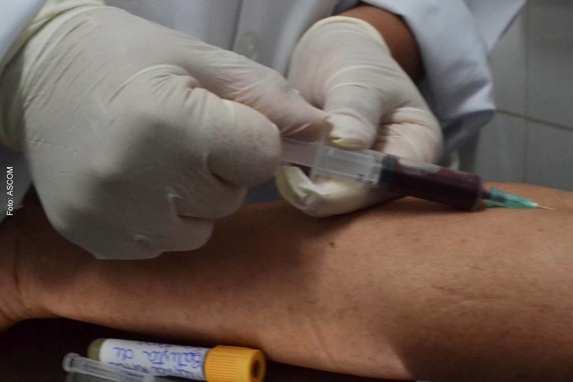 Outra opção para realizar o exame é o Ambulatório Municipal de Infectologia.