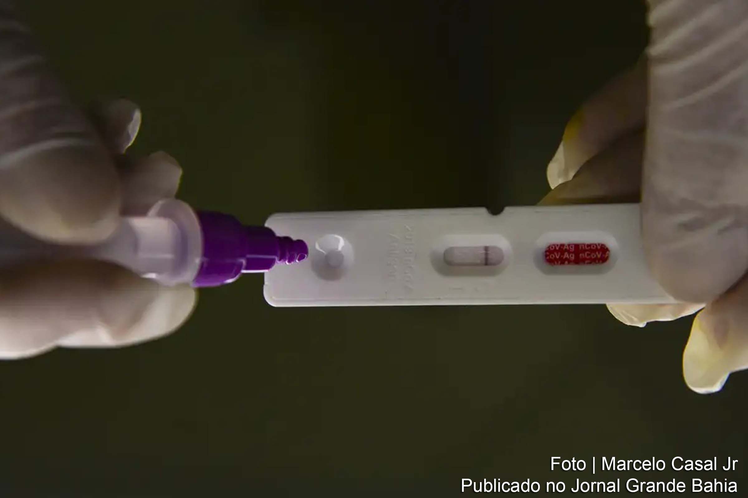 Relatório da Fiocruz destaca heterogeneidade nos casos de Covid-19 no país.