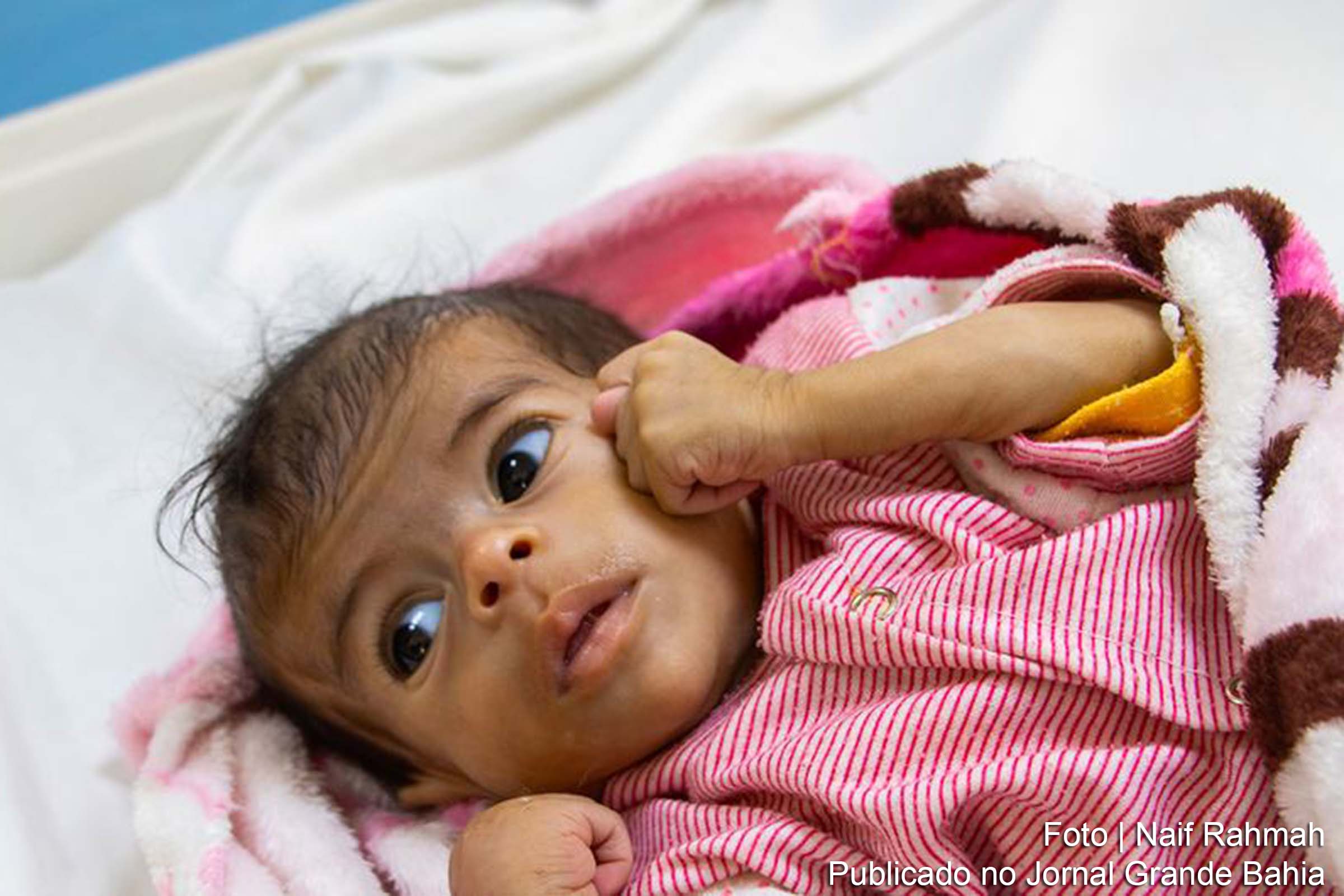 Fome é iminente em quatro distritos do Iêmen, alertam especialistas