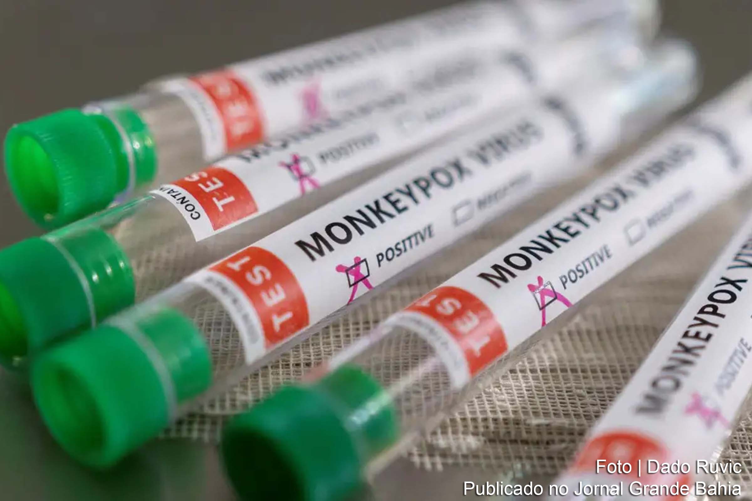 Organização Mundial da Saúde orienta que países atingidos pela variante de mpox iniciem campanhas de vacinação direcionadas.