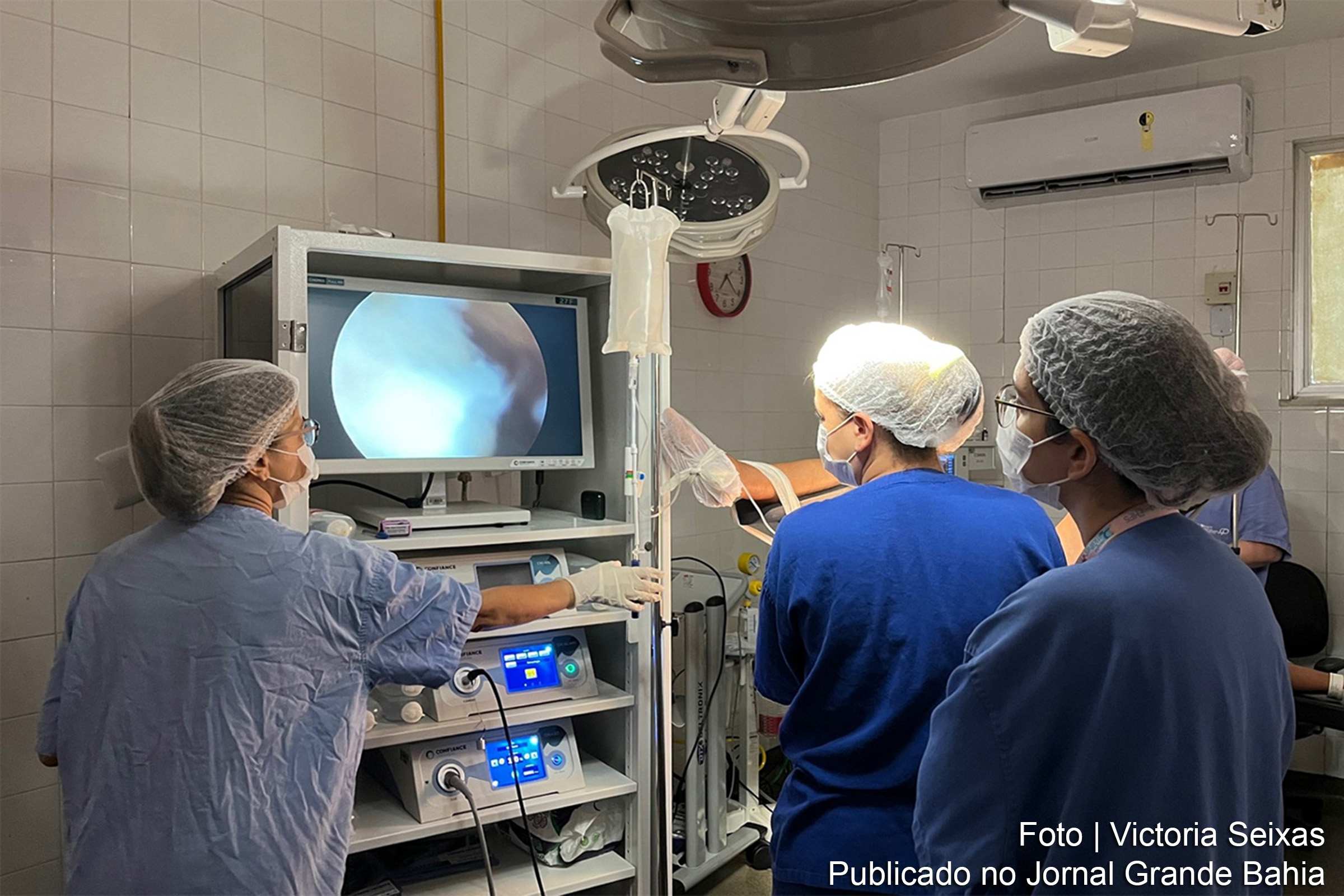 Ação promovida pela Fundação Hospitalar de Feira de Santana atendeu a demanda reprimida na Central Municipal de Regulação, proporcionando diagnósticos ginecológicos essenciais.