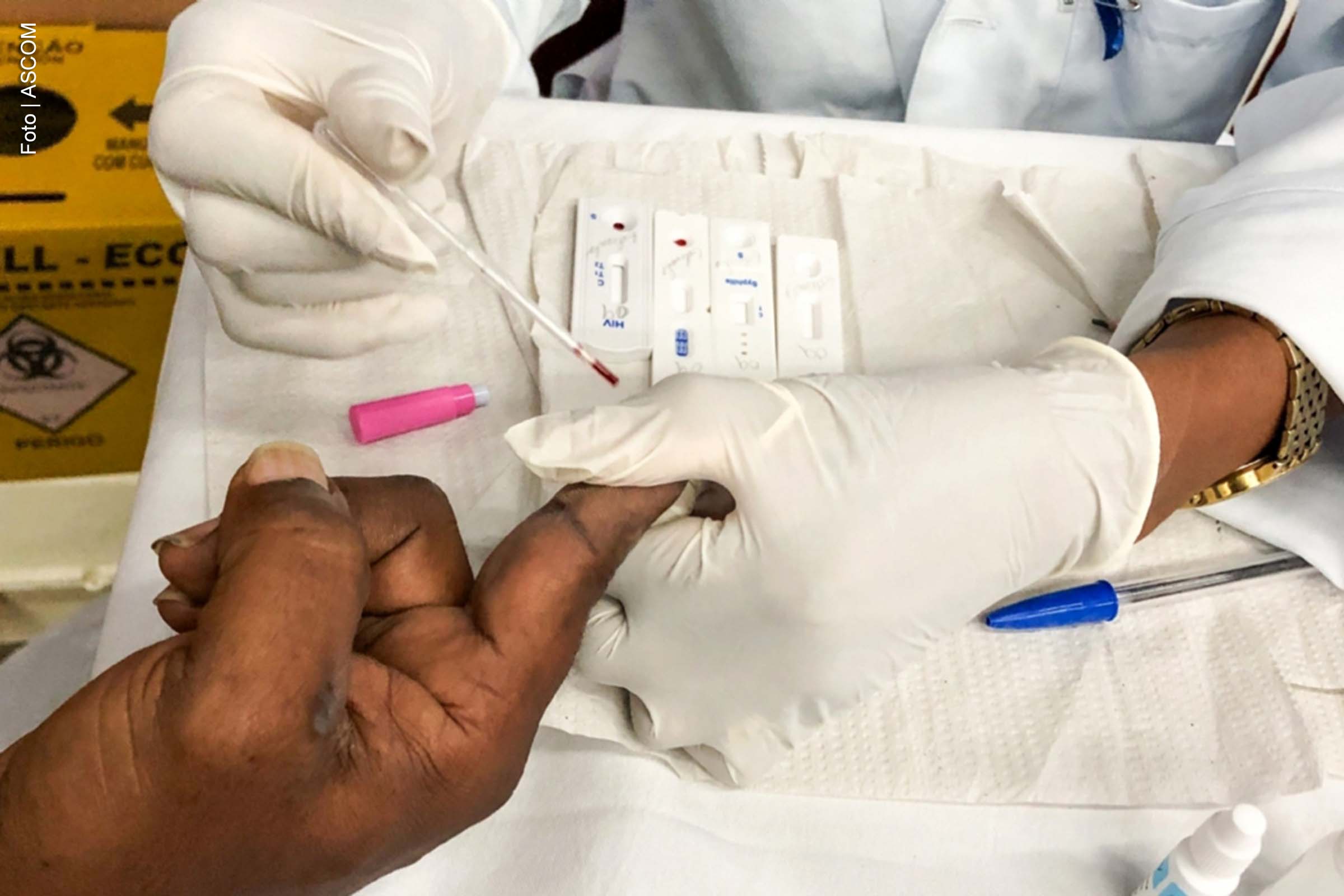 Entre os dias 2 e 6 de dezembro, o Centro de Saúde Especializada (CSE) registrou quatro novos casos de HIV e nove de sífilis, após intensificação das ações de testagem rápida em apoio à campanha Dezembro Vermelho. A unidade ampliou seu atendimento, garantindo maior acesso à população, especialmente àqueles com horários limitados durante o dia.