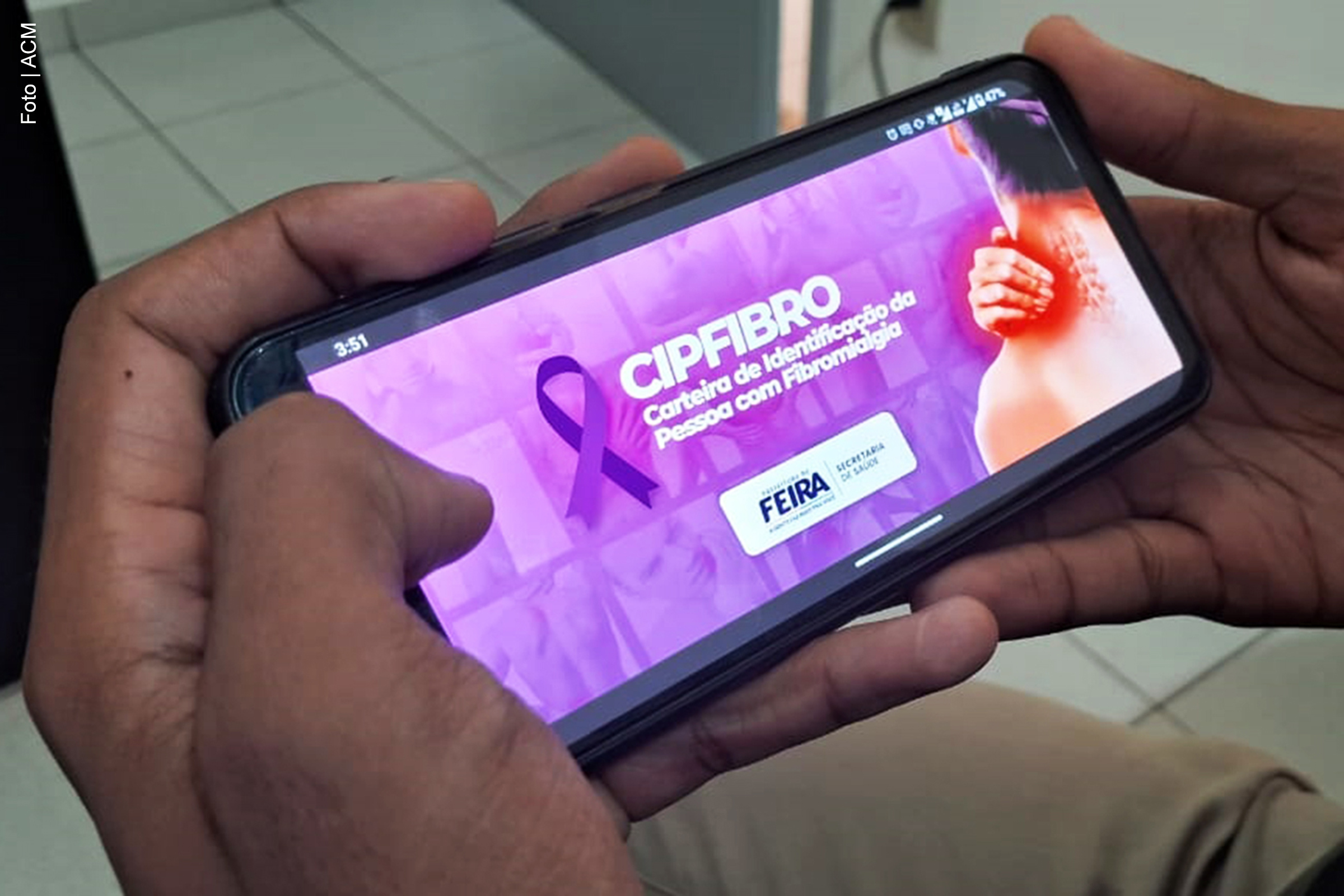 Em alusão ao Fevereiro Roxo, mês de conscientização sobre a fibromialgia, a Prefeitura de Feira de Santana disponibiliza a carteira de identificação (CIPFIBRO), garantindo prioridade no atendimento nas repartições municipais para pessoas diagnosticadas com a condição. O benefício já foi concedido a 680 pessoas, sendo a maior parte composta por mulheres, que representam 95% dos beneficiados. O serviço é exclusivo para os moradores da cidade, com exceção das solicitações da região metropolitana, que foram negadas.